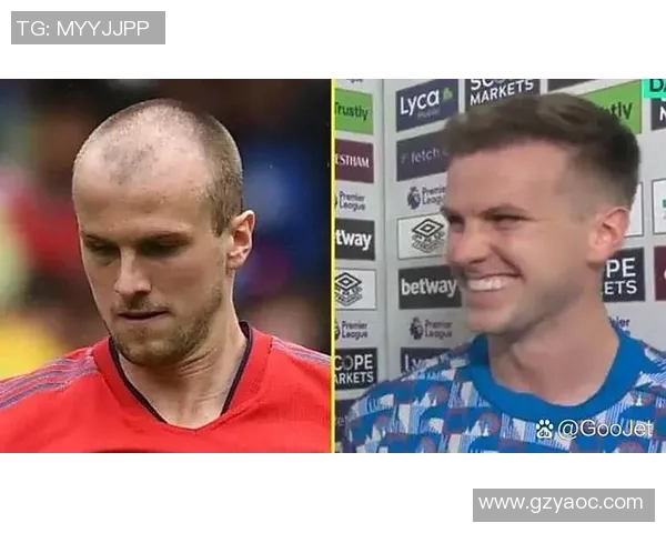 足球明星们的植发故事揭秘你不知道的那些球场背后秘密 足球明星们的植发故事揭秘你不知道的那些球场背后秘密